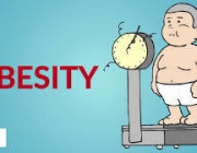 OBESITY